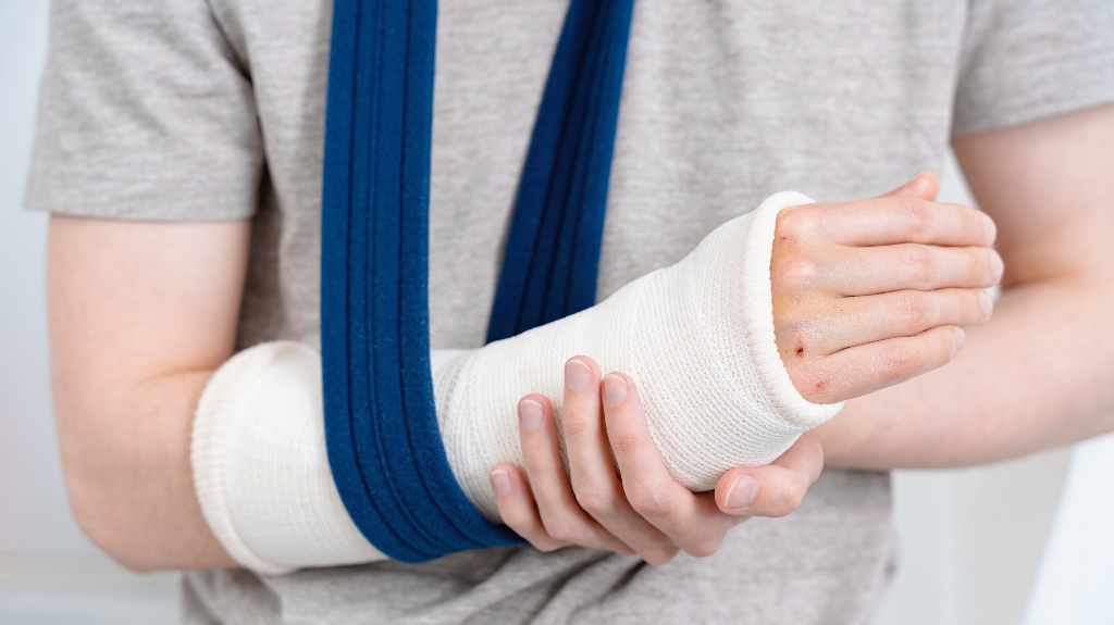 person with a broken arm in a white cast